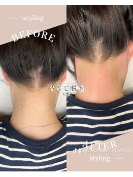 ホワイトワックス 京都四条烏丸(WHITE WAX)/WAXでうなじ美人!