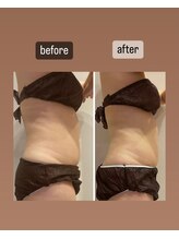 ララ(LALA)/痩身デトックスリンパマッサージ