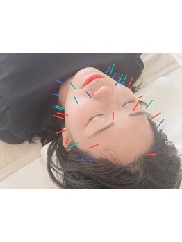 鍼灸施術を受けたい