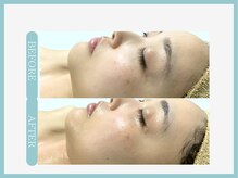 アコガレコガオ 仙台店/