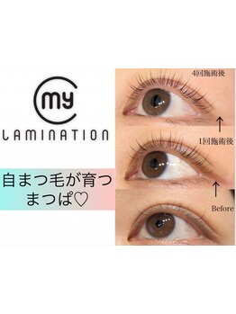 まつげのお悩み解決サロン