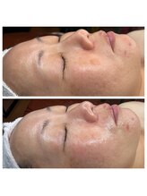 サロン ド マーシャ(salon de Marsha)/ホームケアの大切さ