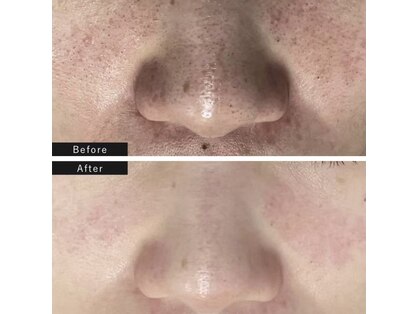 ビューティーサロンエイト(Beauty Salon8)の写真