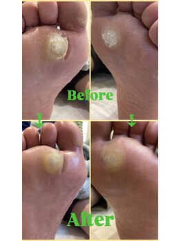 リゼラアンドコー 野洲店/