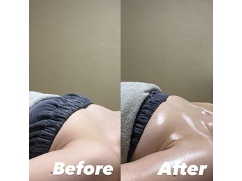 オンユ(Onyu)/ビフォーアフター2