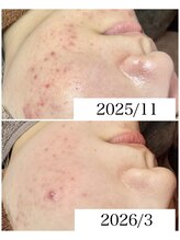 ブラックボックス(BLACK BOX)/20代女性のお客様