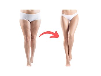 ヨサパーク ロワゾーブルー(YOSA PARK Loiseau blue)の写真/【下半身痩せしたい方へ】むくみ解消×温熱美脚サイズダウン¥9800→¥8800