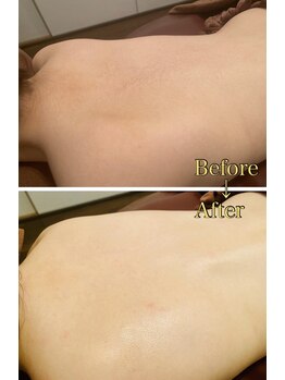 コモド(COMODO)/ブライダルシェービング