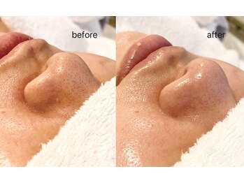 シエル(ciel)/before→after