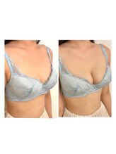 ソラ(sora)/バストアップ・バストケア症例★