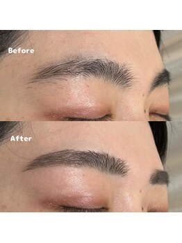 アイラ 新越谷店(EYELA)/WAX脱毛