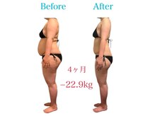 トータルケアーサロン アクア 時津(AQUA)/ダイエット　ビフォーアフター