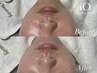 【刺激なく毛穴&保湿ケア】敏感でピーリングが出来ない方にも◎