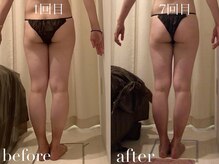 上野エステサロン レア(Lea)/痩身×足引き締め