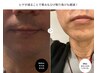 《人気No. 1セット◎清潔感UP》ヒゲ脱毛　60分 1回/¥6,000円