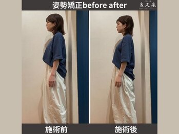 ととのえ処 良久庵/姿勢矯正