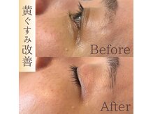 アネーロ(Anhelo)の雰囲気（#しわシミ#たるみ#顔脱毛#札幌#美白#美肌#小じわ#ハリツヤ#毛穴）