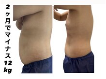 ジール(ZEAL)/痩身/ダイエットプランのお客様