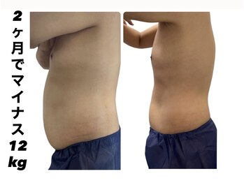 ジール(ZEAL)/痩身/ダイエットプランのお客様