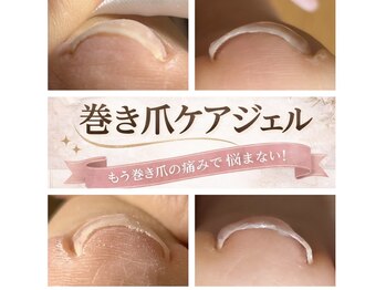 モエラニ(Moe Lani)/巻き爪ケア