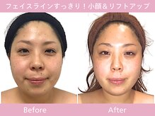 小顔フェイスラボ 難波店(小顔 Face Labo)の雰囲気（たった2か月で、痩せた？って言われるくらいの変化を実感♪）