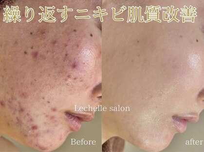レシェルサロン(Lechelle Salon)の写真