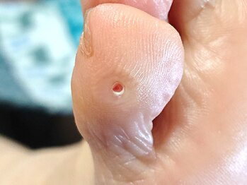 練馬フットケアセンター/◆ドイツ式トータルフットケア☆