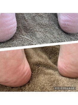 ゲンネイル(gen Nail)/角質ケアもやっています!
