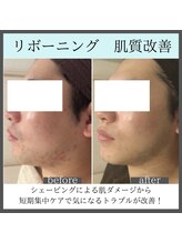 トータルビューティーサロン レビュー(REVIEW)/【Before/After】リボーニング