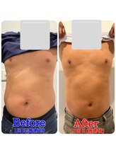 ファビー(Fabby)/マグフォース10回のビフォアフ