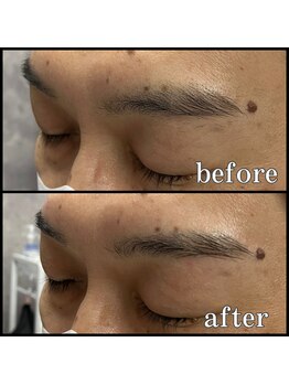 眉毛男子 新宿店/眉毛のbefore/after 