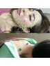【人気NO1◎美容＆肩腰痛】美容鍼+頭肩腰に鍼とマッサージ 90分 11150→