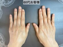 桃の木 吉祥寺店/綺麗な手は維持出来ます　4