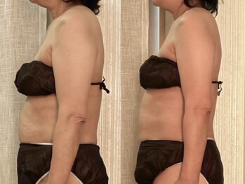 マイティー整骨院 ココア(CoCoa)/活性リンパ洗浄