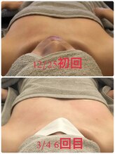 サロン ワン(salon one)/施術８回目