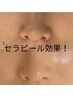 人気NO4/全員OK【セラピール】毛穴洗浄&超音波洗浄×パック×LDM ¥9900