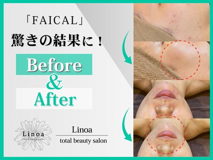 リノア(Linoa)の写真
