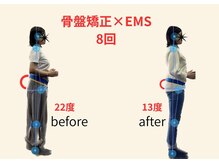 リボーン(REBORN)/整体/骨盤矯正/EMS