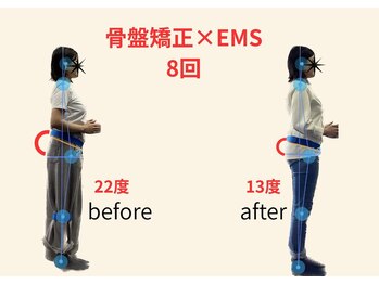 リボーン(REBORN)/整体/骨盤矯正/EMS