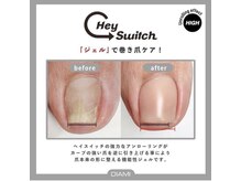 フィグ ツリー(fig tree)の雰囲気（サンダルの季節に向けて準備はじめまさんか？巻き爪&角質care）