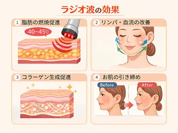 フレキシボディ(FlexiBody)/