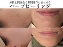 ジプソフィラフィフティドット(gypsophira15.)