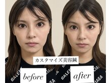 マホロバ(mahoroba)の雰囲気（安心個室/美容鍼でリフトアップ/小顔/むくみ/ほうれい線改善◎）