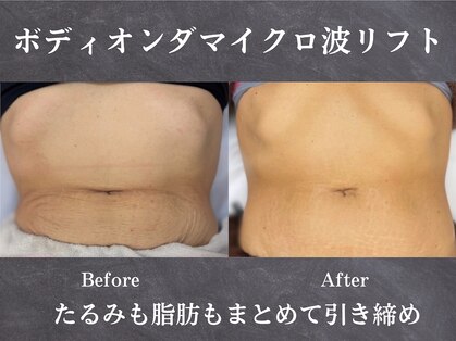 イロハ(IROHA)の写真