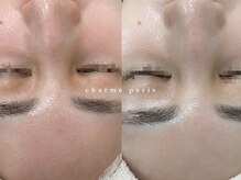 シャルムパリス(charme paris)の雰囲気（【諦めていた肌もご相談ください】赤み/痒み/乾燥肌/敏感肌）