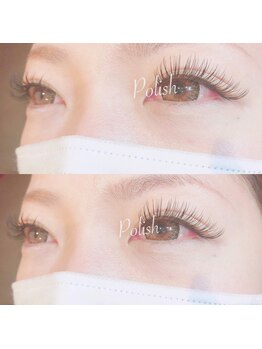 ビューティーホスピタル(Beauty Hospital)/付け放題コース