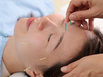 野と花鍼灸院/美容鍼もしています。