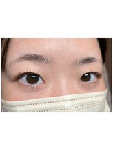 キャンディベース ノースアップ(Candybase North up)/大人気ラッシュリフト