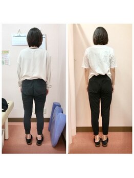 寝屋川鍼灸整骨院/産後骨盤矯正