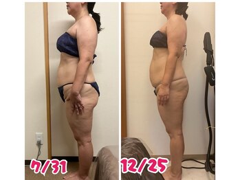 スマイルボディ つぼの森 加治木店(Smile body)/ラジオ波